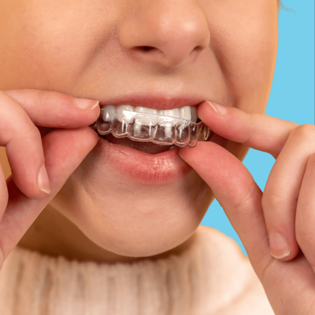 Dental Orthodontic Essix Retainers | Custom fit UPPER & LOWER